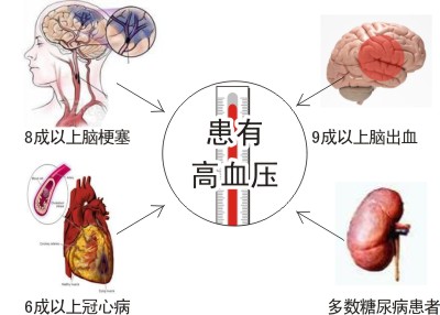 食疗：高血压食疗养生方